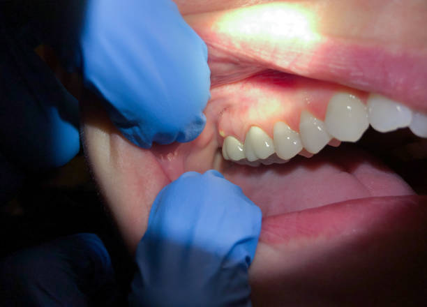 Best Pediatric Emergency Dentist in Skiato, OK