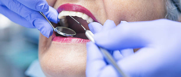 Best Emergency Wisdom Teeth Removal in Skiato, OK